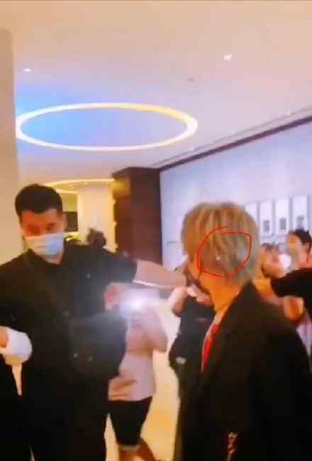 照射 刘雨昕被激光笔照射是怎么回事 被激光笔照射都有哪些危害
