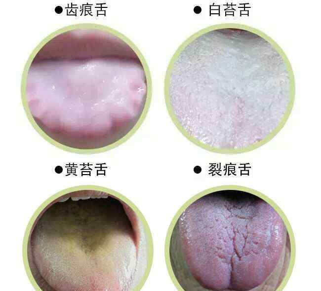 舌苔重 舌苔厚白发黄，体内湿毒严重，教你如何处理！
