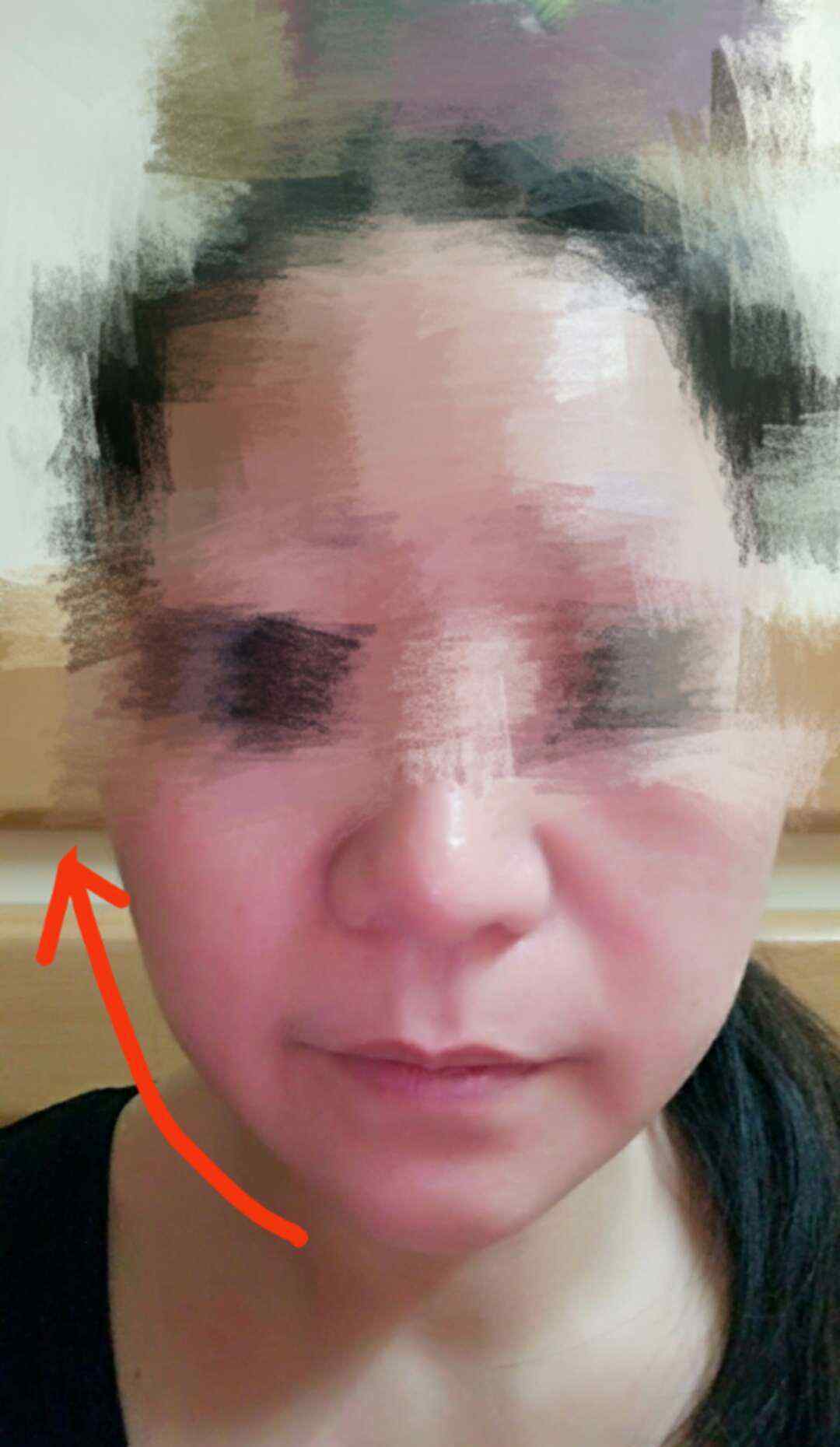 中医美容学习班 中医美容班招生
