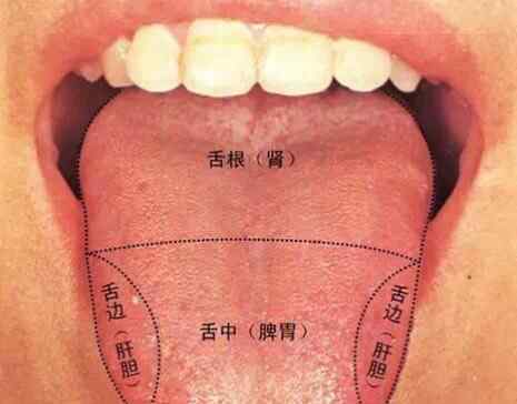 舌苔图片看病图解 舌诊的学问，通过舌头看病，附带治疗方法