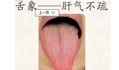 舌苔图片看病图解 舌诊的学问，通过舌头看病，附带治疗方法