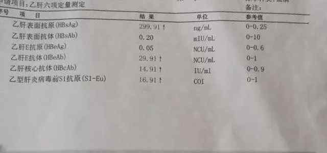 乙肝五项查验结果分析,假如乙肝病毒核心抗体