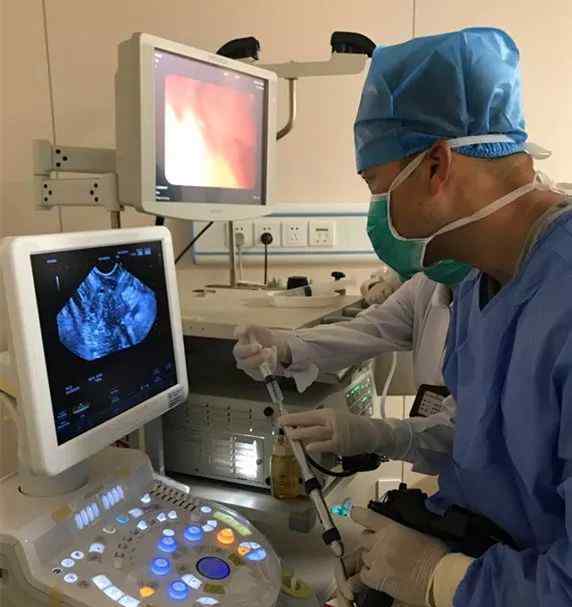 超声内镜正确引导下病原体溶瘤医治