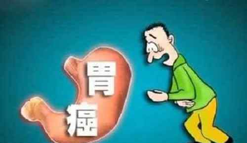 直肠癌的初期能够出现下列七个层面的病症!