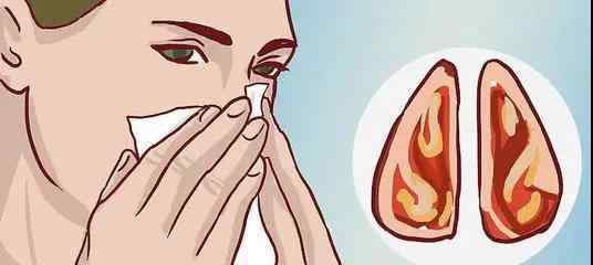 单纯性鼻炎与慢性 慢性单纯性鼻炎须重视