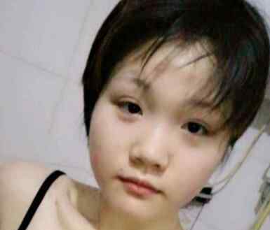 肉鼻子好看吗 大肉鼻子女生发型图片 大肉鼻子扎什么发型好看