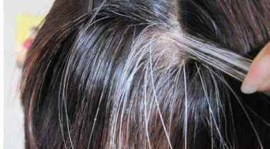 治疗白发的偏方 如何治疗白发 治疗白发的最好方法介绍