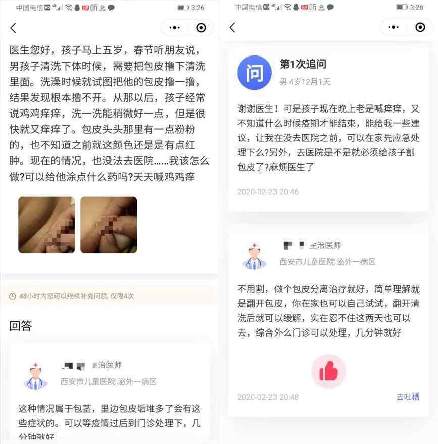 五岁儿子是相公 为了翻开5岁儿子的包皮，我们全家齐上阵