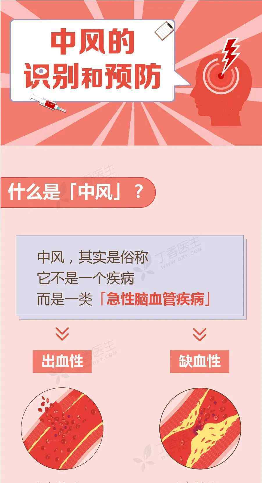 中风前兆 【世界预防中风日】3个中风前兆，尽早发现能救命~！