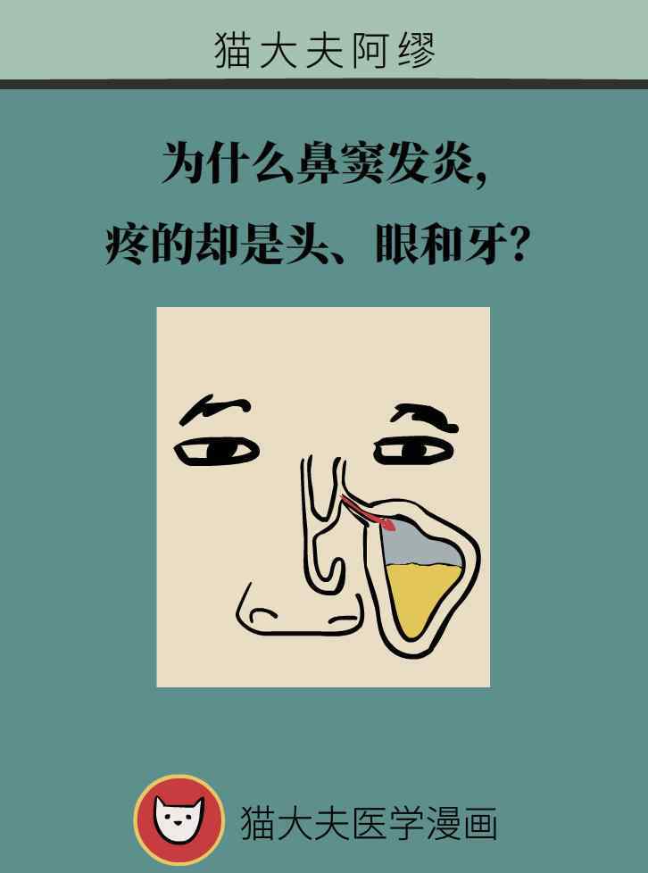 鼻窦炎牙酸 为什么鼻窦发炎， 疼的却是头、眼和牙？