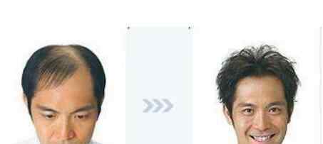 鬼剃头发型 鬼剃头发型适合什么脸型