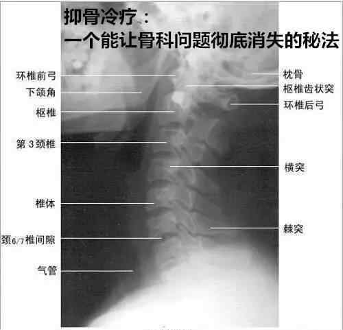 颈椎骨退行性病变的具体表有哪些方面?