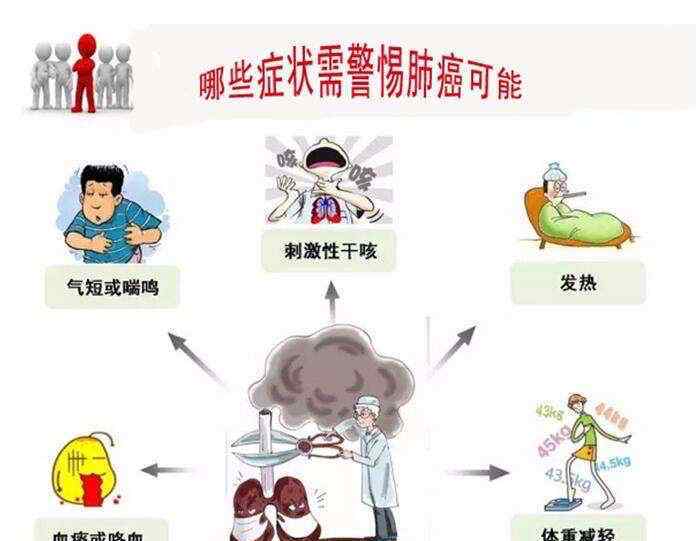 声音嘶哑是肺癌哪一期 声音嘶哑原来是肺癌惹的祸