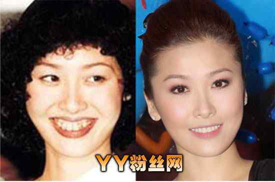 周丽淇个人资料 周丽淇整容前后照片对比老公是谁 周丽淇个人资料年龄多大了