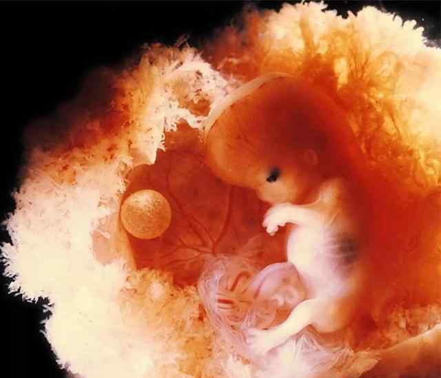 未出世的胎儿跟外部隔着一层肚子,飞雪流星飘花