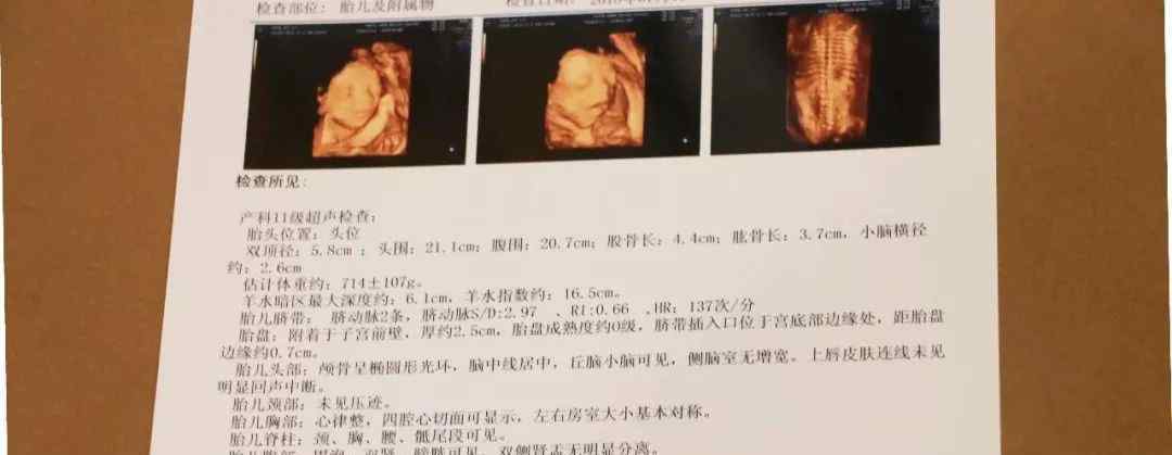 四维彩超胎儿双顶径是啥怀的男宝宝还是女宝宝?