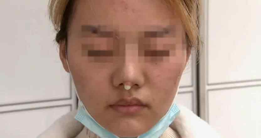 漂亮姑娘刚怀孕脸上长出神秘白色物体 婆婆一追问瞒不住了（图）