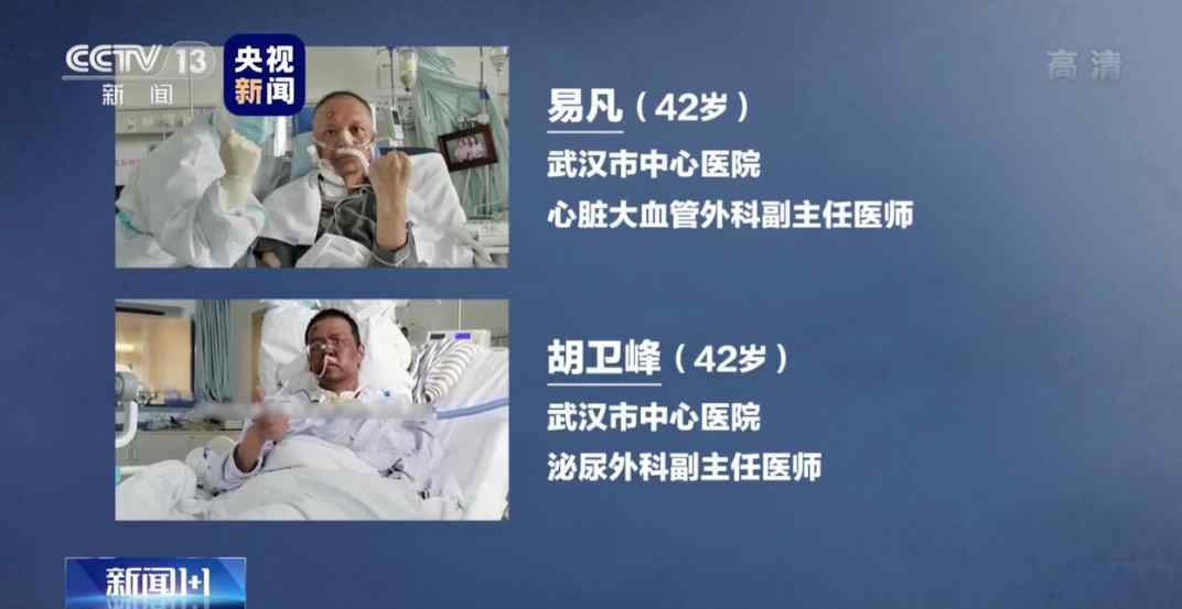 脸变黑怎么回事 令人揪心!武汉面容变黑医生出现脑出血症状 具体是怎么回事?