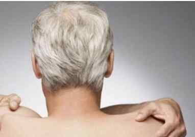 治疗白发的方法 白发怎么治 常见的治疗白发的方法介绍