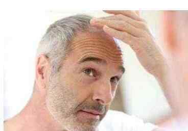治疗白发的方法 白发怎么治 常见的治疗白发的方法介绍