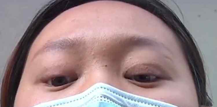 郑州女子医院来问现代 郑州女子整形失败，每天睁眼睡觉，医院愿意赔钱却不承认手术失败