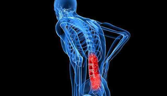 哪种背痛是肿瘤引起的 后背疼很常见，但是这5个原因要小心，其中一个是肿瘤