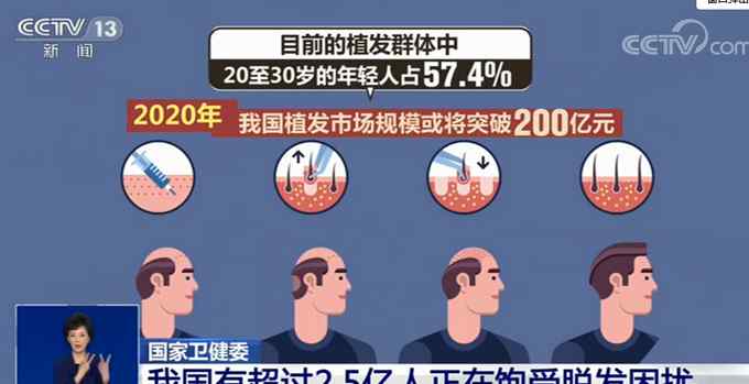 “秃”如其来的烦恼！我国超2.5亿人受脱发困扰 专家给出四点建议