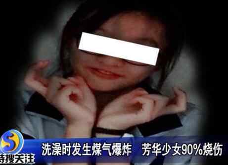 惨不忍睹 惨不忍睹！少女洗澡煤气爆炸 17岁女孩出来时全身上下已是“火人”