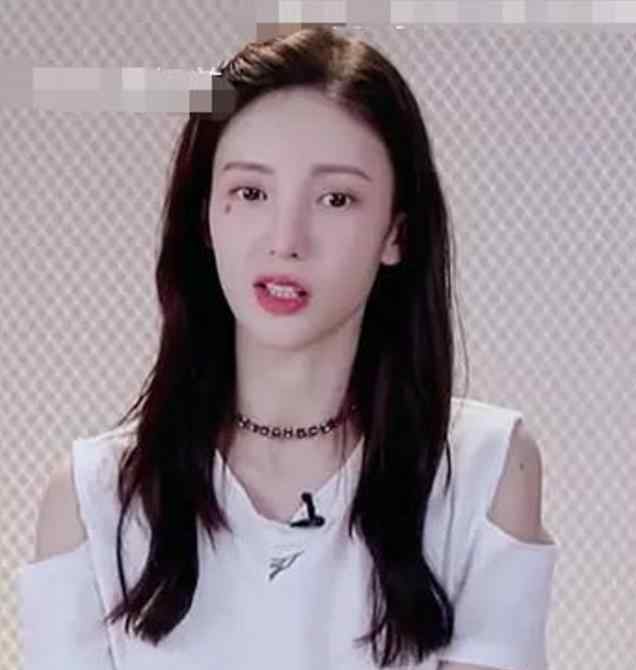 嘴歪是什么原因造成的 金晨回应嘴歪是怎么回事？什么情况？终于真相了！原来是这样！
