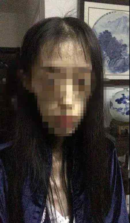 骨瘦如柴的女人 要瘦不要命？女孩减肥剩50斤 她骨瘦如柴的样子太恐怖