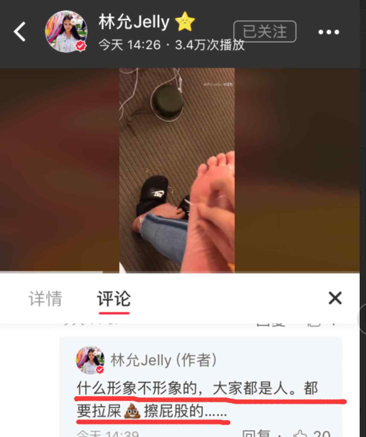 林允回应撕脚皮 画面有点恐怖！林允回应撕脚皮：什么形象不形象的大家都是人！