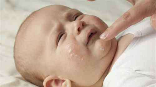婴儿干性湿疹 婴儿干性湿疹的原因 婴儿干性湿疹怎么治
