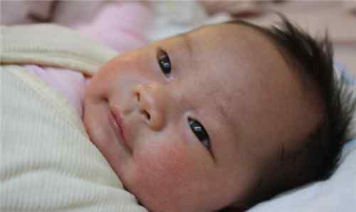 初生婴儿湿疹 刚出生的婴儿湿疹怎么办  新生儿长湿疹如何护理