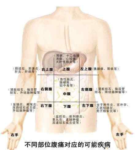 肚子疼的图片 看懂一张图 让你懂得肚子疼对应的各种疾病