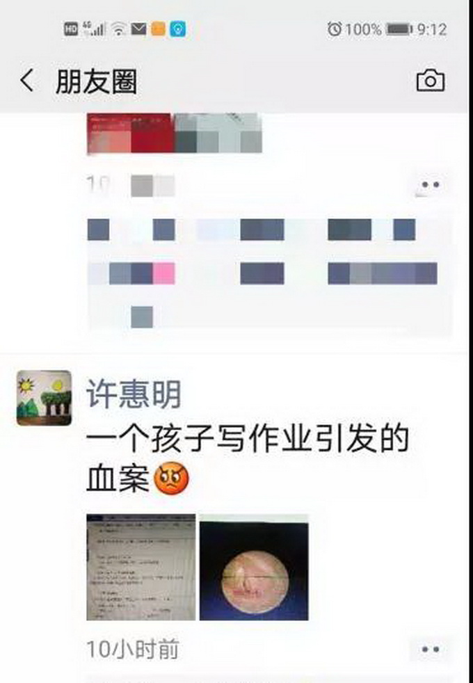 又是因为做作业！杭州俩男孩接连紧急送医 爸爸后悔：本来只想吓唬吓唬