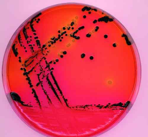 志贺菌 493人已经感染，他们能康复吗？志贺氏菌和细菌性痢疾有何联系