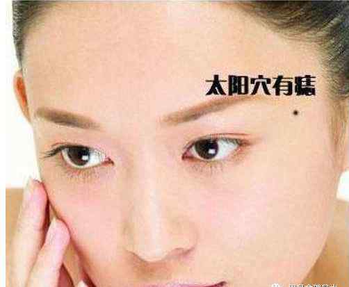 痦子和痣的区别 吉痣和恶痣的区别特征