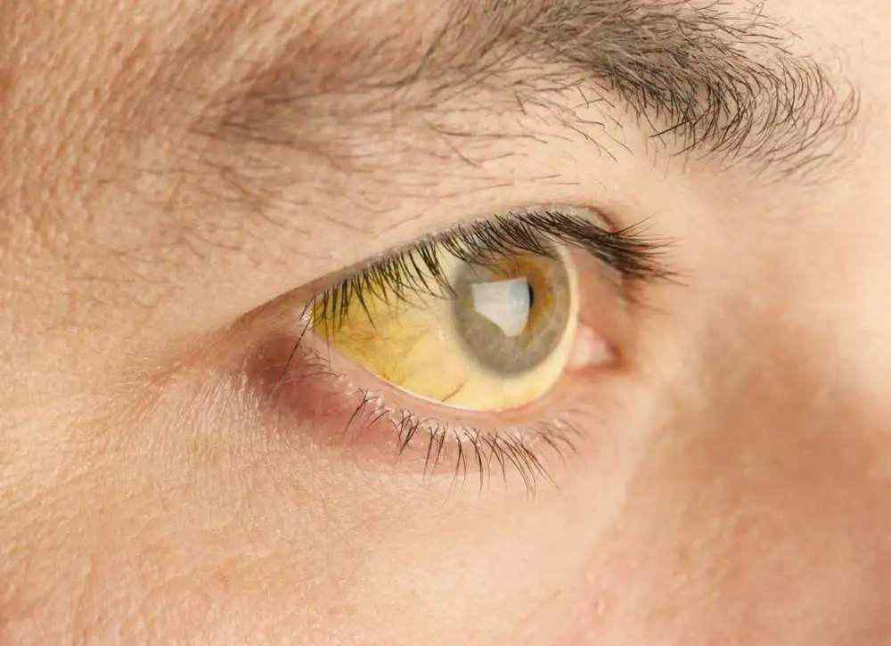 眼睛是心灵的窗户 眼睛是心灵的窗户，若出现这5种变化，或是身体不健康的“征兆”