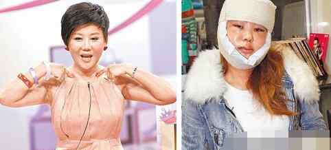 明星整容前后照片 整容失败的明星都有谁 女星整容前后照片对比