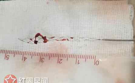 打游戏3天3夜 大学生打游戏3天3夜 放飞自我变成中风入院