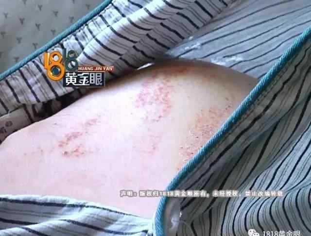 四人情头 杭州一代驾小伙看了几眼街边小情侣 被四人群殴