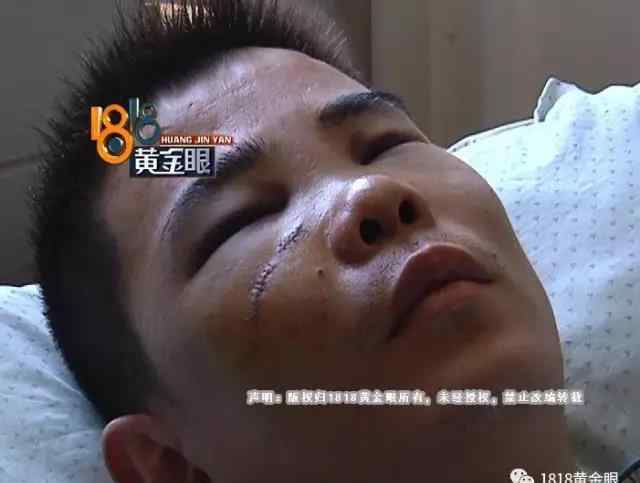 四人情头 杭州一代驾小伙看了几眼街边小情侣 被四人群殴
