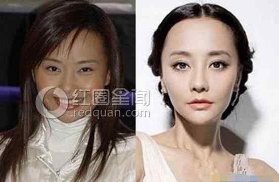 马雅舒整容前后 盘点女明星整容失败照片 明星整容照最大差距的是谁