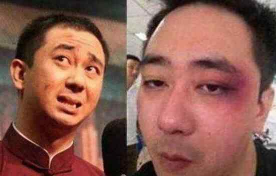 王自健老婆真的很厉害 王自健被老婆打是真的吗 跟前妻离婚后又结婚了吗