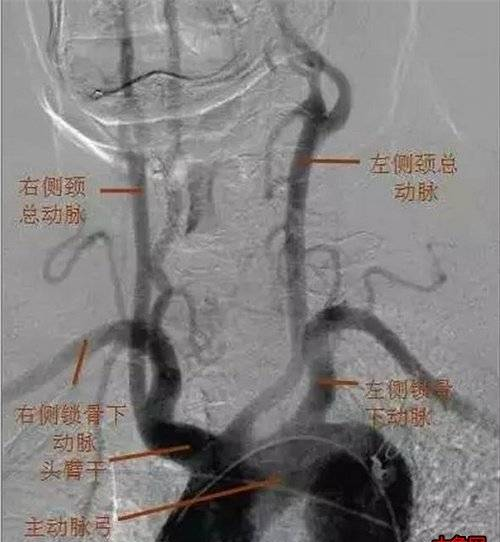 王小国