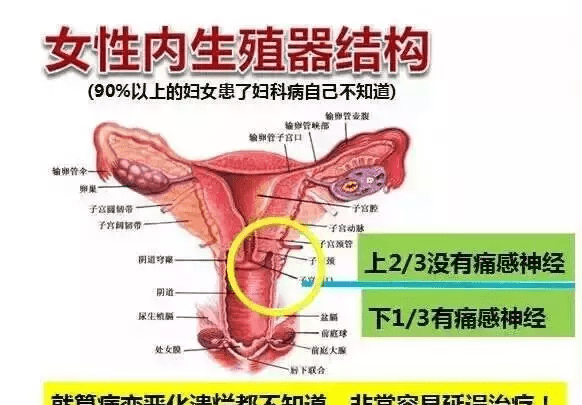 为什么中国女性妇科疾病发病率居全球首位？