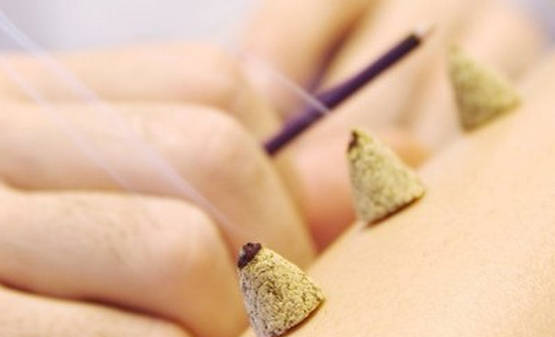 艾条常见的四大使用用法