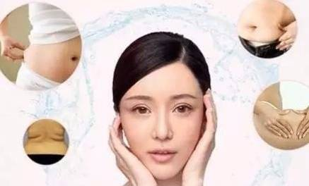 自体脂肪面部填充，准备做第二次填充了