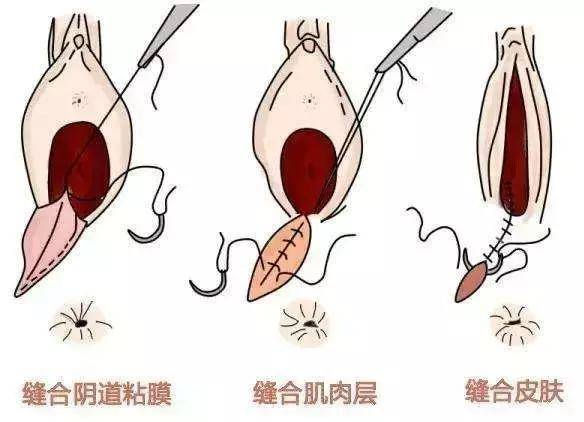 宝惠商城