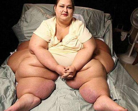 世界上最胖的女人有多重？900斤！减肥成功收获爱情！